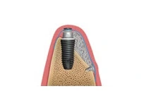 회복을 확인하며 다음 단계를 정합니다